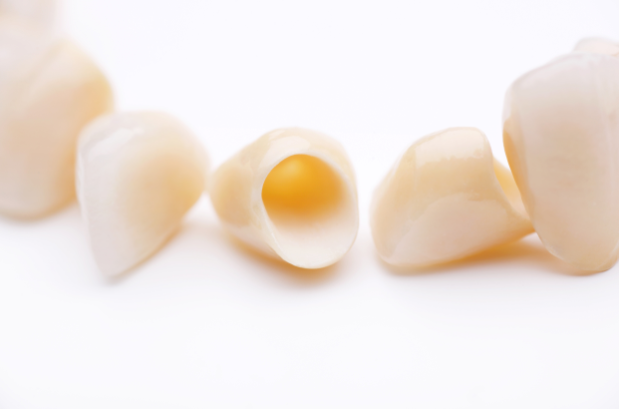 dental crowns | CEREC Crowns in Monroe MI | Kuras Dental Health Associates